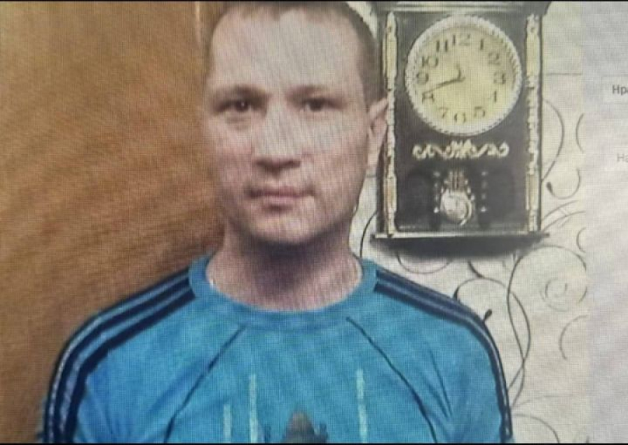 В Челнах ищут мужчину со шрамами на лице и губах